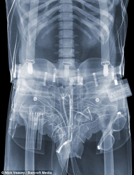 porn x ray|Free Xray Porn Videos .